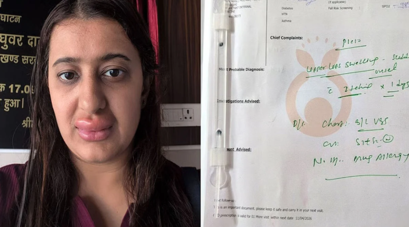 বন্দে ভারতের খাবার খেয়ে ঠোঁট ফুলে ঢোল! তরুণী অভিযোগ জানাতেই সমালোচনায় বিদ্ধ রেল বেস্ট কলকাতা নিউজ : বন্দে ভারতের খাবার খেয়ে ঠোঁট ফুলে ঢোল! তরুণী অভিযোগ জানাতেই সমালোচনায় বিদ্ধ রেল